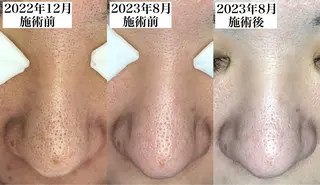 Soare(ソアレ)所属・【結果重視】 毛穴専門店のエステ・リラクイメージ