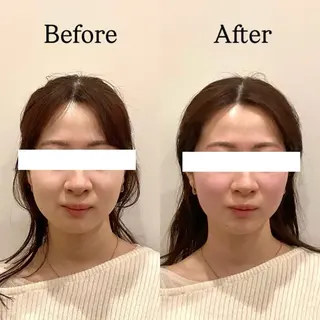 Hari Lounge恵比寿所属・chika🦋 ハリラウンジ恵比寿のエステ・リラクイメージ