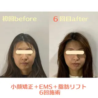 最速小顔・肌質管理 ❣️エスポワールのエステ・リラクイメージ