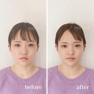 はり灸サロン　totonoi所属・筋膜リリース 小顔美容鍼のエステ・リラクイメージ