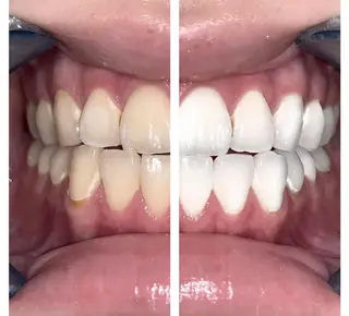 ショート ヘアアレンジ ネイル マツエク・マツパ メンズ カラー パーマ アイブロウ キッズ ライトビューティー 銀座本店のエステ・リラクイメージ