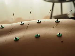 鍼灸•マッサージサロンCalfa所属・《美肌･小顔》美容鍼 ＆マッサージ＊MEIのエステ・リラクイメージ