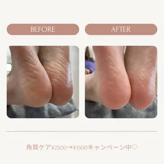 ネイル Aurum ♡︎ miyukiのネイルデザイン