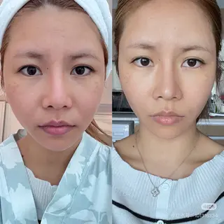 マツエク・マツパ aliaハイフ&水光ジェットサロン所属・aliaハーブ水光店 エステティシャン募集のエステ・リラクイメージ