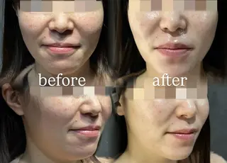 🪞Purasia. 🫧韓国肌管理💎のエステ・リラクイメージ