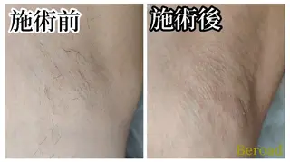 メンズ 脱毛＆フェイシャル　Beroad【ビロード】美道所属・脱毛＆フェイシャル Beroad  美道のエステ・リラクイメージ