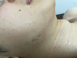 メンズ キッズ 脱毛SALON RaYNiCKのエステ・リラクイメージ