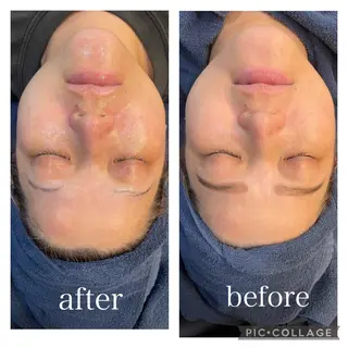 leolo武蔵浦和 肌質改善＆脱毛のエステ・リラクイメージ