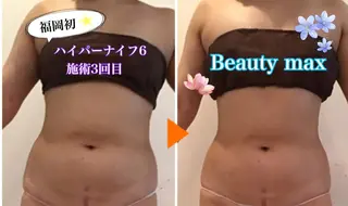 Beauty Maxのエステ・リラクイメージ