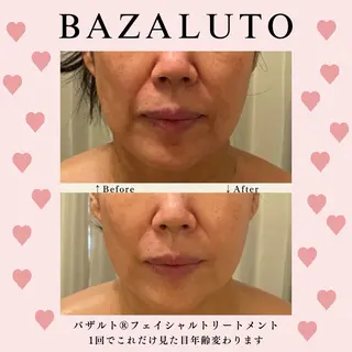 糸島 エステサロンmiuのエステ・リラクイメージ