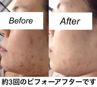 ネイル マツエク・マツパ 都度払い肌質改善 &脱毛Blancheのエステ・リラクイメージ