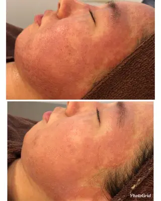 セミロング カラー パーマ ヘアアレンジ メンズ キッズ ネイル マツエク・マツパ 四つ星サロン🎖 腸＆ニキビケアに特化のエステ・リラクイメージ