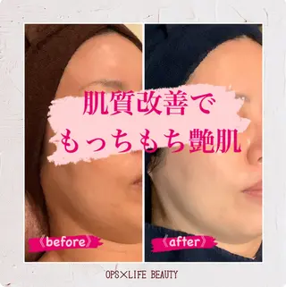 メンズ OPS×LIFE BEAUTY所属・OPS×LIFE BEAUTY/maiのエステ・リラクイメージ