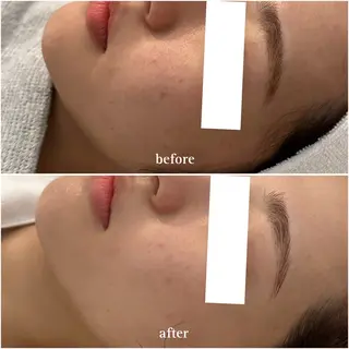 肌質改善 ¦ POLA¦カワナベのエステ・リラクイメージ