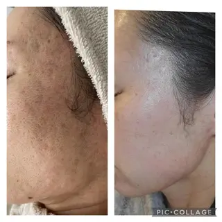 ネイル マツエク・マツパ アイブロウ total beauty  salon RIRE所属・古川 弥生のエステ・リラクイメージ