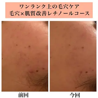 Bellesthe (ベルエステ)のエステ・リラクイメージ