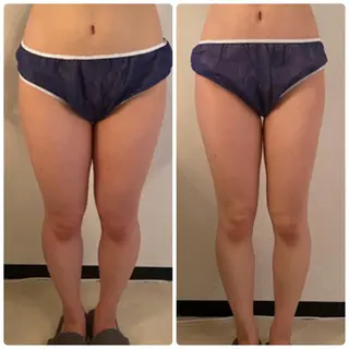 FLEUR大阪・整体 ・ハイフ・痩身・小顔のエステ・リラクイメージ