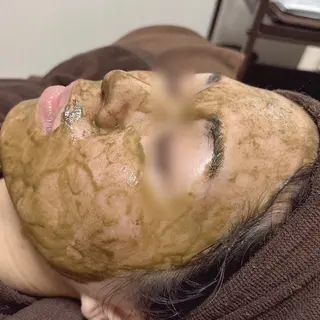 肌質改善Charme coco  みさのエステ・リラクイメージ