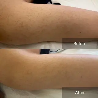 clé skin 🌿ハーブピーリングのエステ・リラクイメージ
