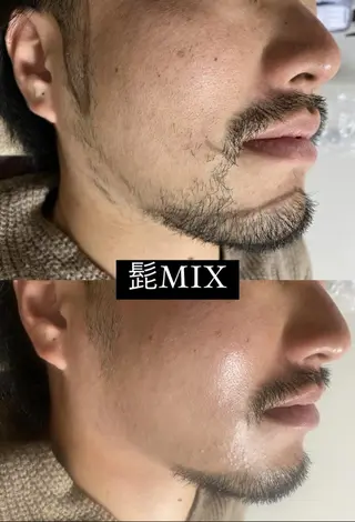 メンズ Epina 千葉店 【エピナ】のエステ・リラクイメージ