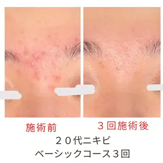 ベラージュ【美背中・ 美尻・フェイシャル】のエステ・リラクイメージ