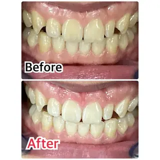 プラチナムビューティー柏所属・【歯科提携】柏ホワイ トニングスタイルのその他イメージ