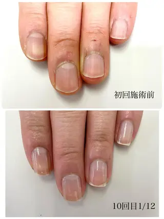 ネイル TiALASH ＊Kozue＊のネイルデザイン