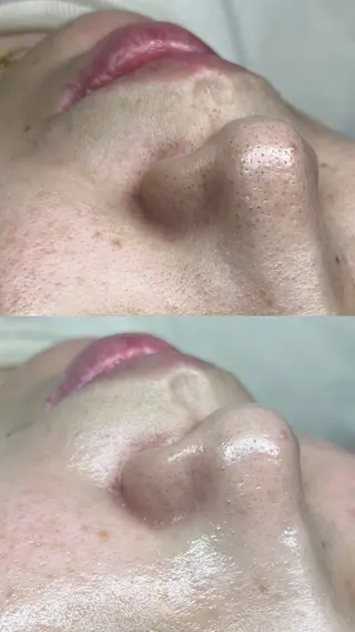 韓国式美人肌育成/美肌WAXサロン【L_style.】所属・【L_style.】 エルスタイルのエステ・リラクイメージ