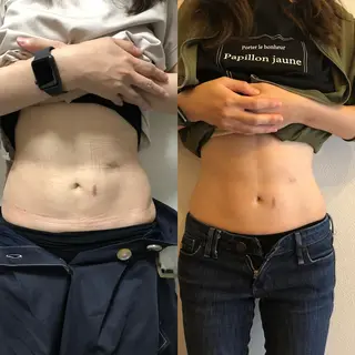 鹿児島腸もみサロン Deparchoのエステ・リラクイメージ