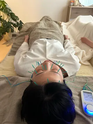 鍼灸•マッサージサロンCalfa所属・《美肌･小顔》美容鍼 ＆マッサージ＊MEIのエステ・リラクイメージ