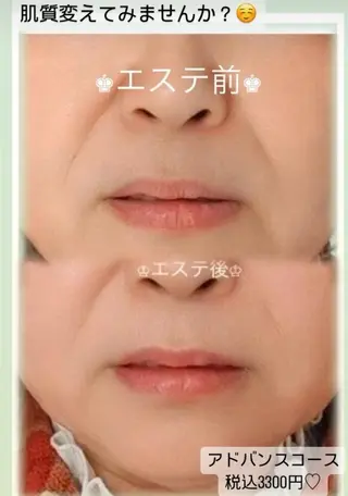 メナード熊本 嘉島のエステ・リラクイメージ