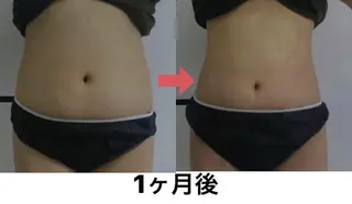 横浜エステサロン R-ing リングのエステ・リラクイメージ