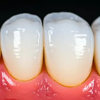 ホワイトニングサロン nico西葛西店のその他イメージ