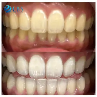 LBSホワイトニング 銀座店💎スタッフ峯のその他イメージ