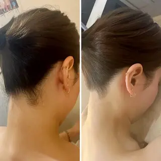 うなじ脱毛/美肌脱毛 LABELのエステ・リラクイメージ