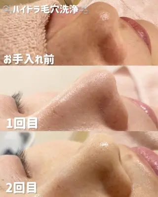 lulularico Yuのエステ・リラクイメージ