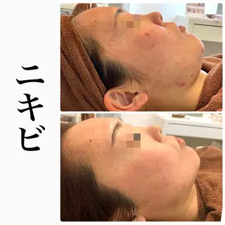 ハーブピーリング専門 BIOPLUS+川崎のエステ・リラクイメージ