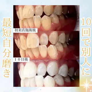 メンズ ホワイトニング専門店 WHITE天神店のエステ・リラクイメージ