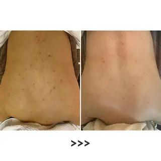 肌質改善 KALANCHOEのエステ・リラクイメージ