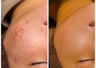 最速小顔・肌質管理 ❣️エスポワールのエステ・リラクイメージ