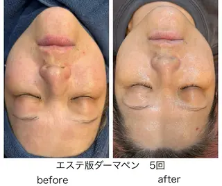 leolo武蔵浦和 肌質改善&脱毛のエステ・リラクイメージ