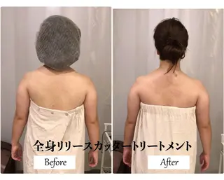 痩身×フェイシャル ブライダル|Linoのエステ・リラクイメージ