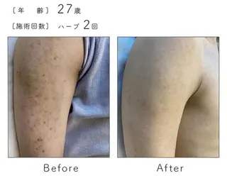 ハーブピーリング専門 BIOPLUS+川崎のエステ・リラクイメージ