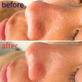 毛穴洗浄特化🫧 オオツカのエステ・リラクイメージ