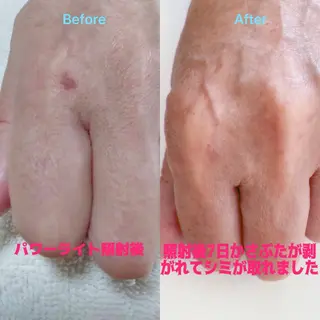 アゲハビューティークリニック所属・アゲハビューティー クリニックのマツエク・マツパデザイン