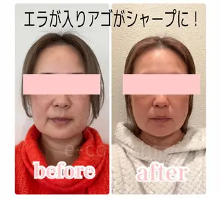 小顔と ヘッドスパのお店のエステ・リラクイメージ