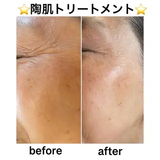 アロマ,陶肌 SalonYokoのエステ・リラクイメージ
