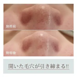 Beauty＆Spa  Chloe所属・Beauty&Spa Chloe のエステ・リラクイメージ