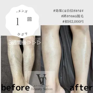 メンズ ATTO SHIORIのエステ・リラクイメージ