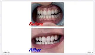 セルフホワイトニングサロン　ラヴィアン所属・ホワイトニングサロン La vie enのその他イメージ